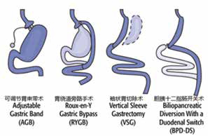 291-292期《全球肿瘤快讯》-43.jpg
