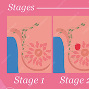 转移性HR+/HER2-乳腺癌 taselisib联合他莫昔芬研究